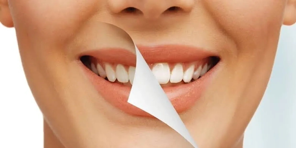 Can Laser Teeth Whitening Damage Your Dental Crowns Woking?