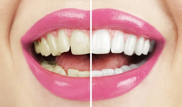 What Early Signs of Oral Cancer Should You Never Ignore Woking?