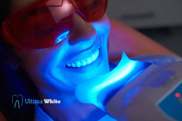 Professional Teeth Whitening Options Woking