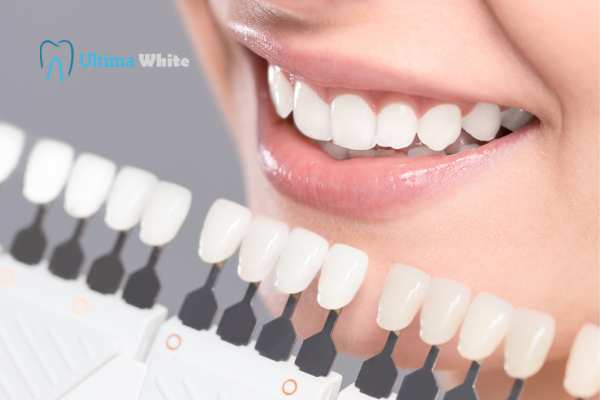 How to Maximise the Results of Your Laser Teeth Whitening Treatment Woking