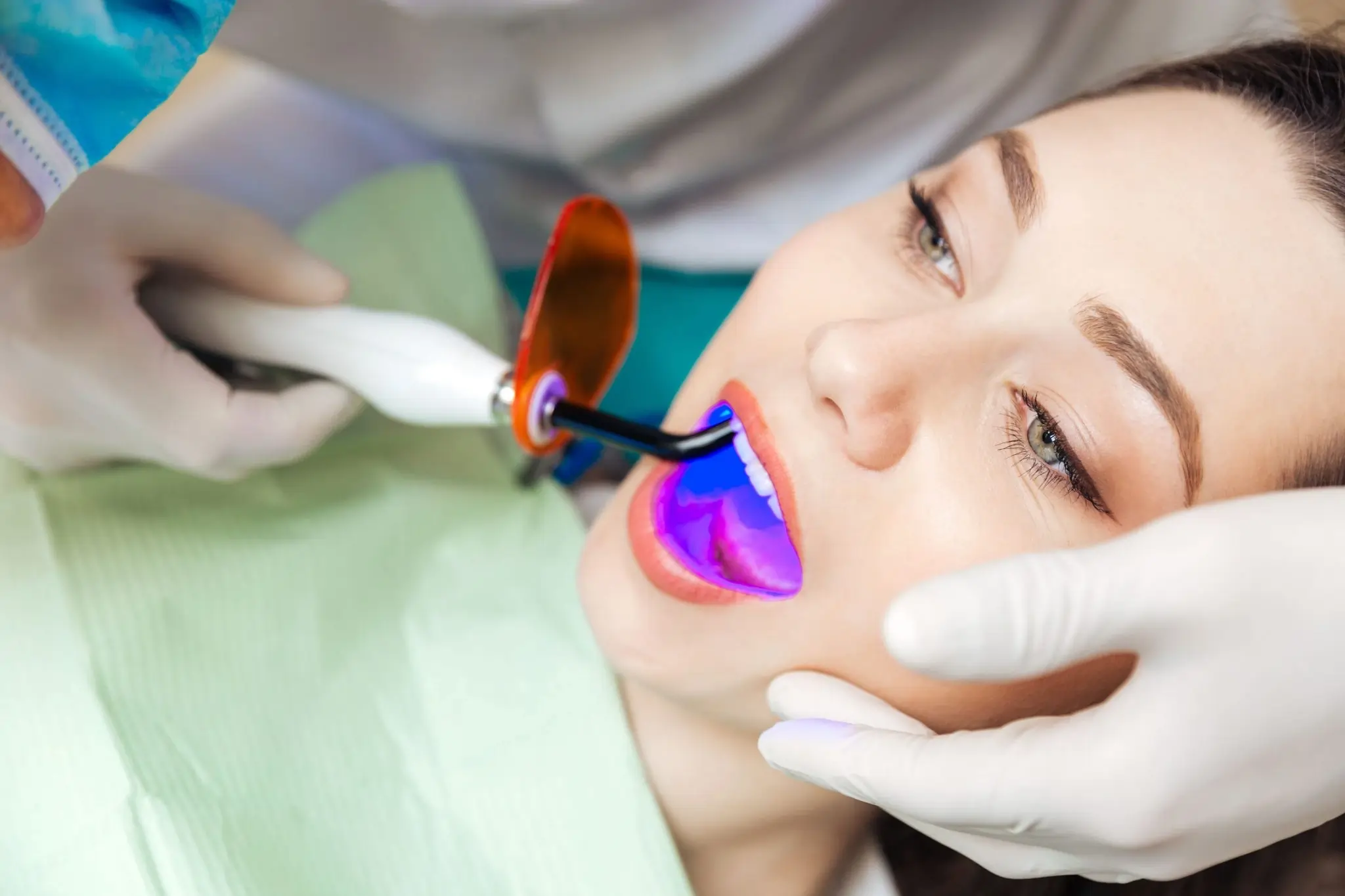 Common Risks of Whitening Without Expert Dental Guidance Woking