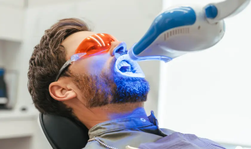The Hidden Differences Between DIY and Professional Teeth Whitening Woking