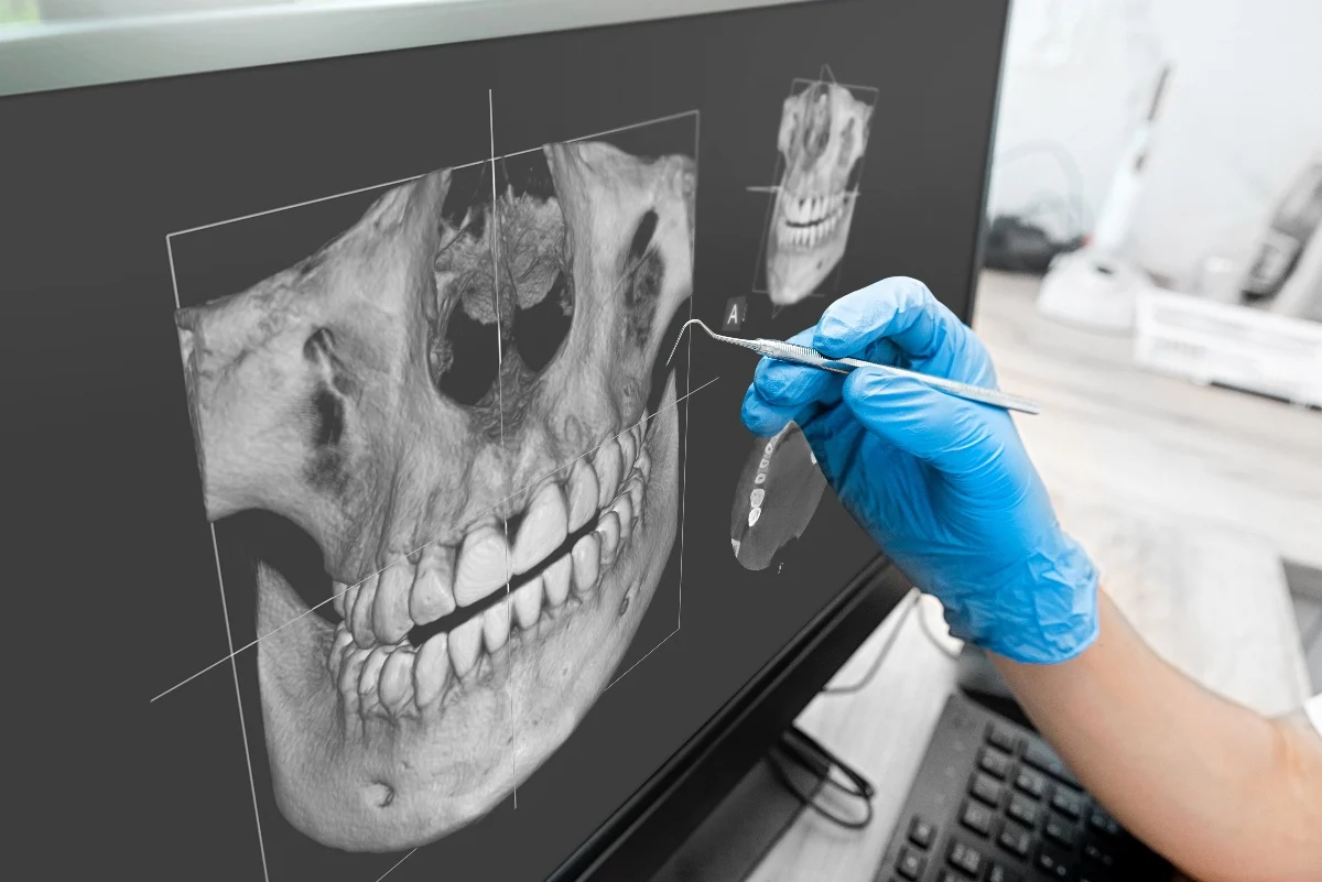 How Is AI Transforming Dental Treatment Planning Woking?