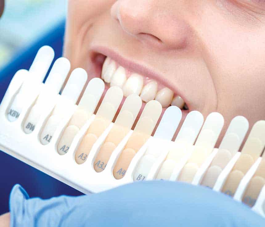 Is Laser Teeth Whitening Worth It for a Brighter, Confident Smile Woking?