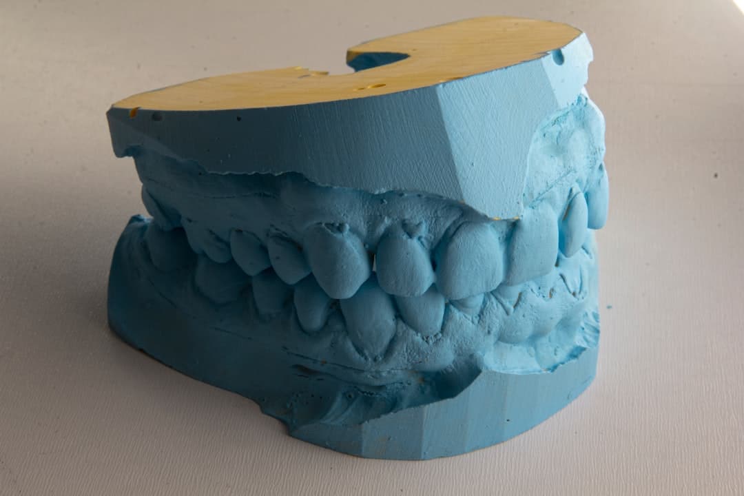 How Do Dental Implants Improve Jawbone Health and Oral Function Woking?