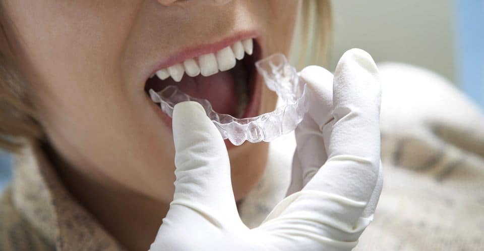 Can Bruxism Affect Your Sleep Quality Woking