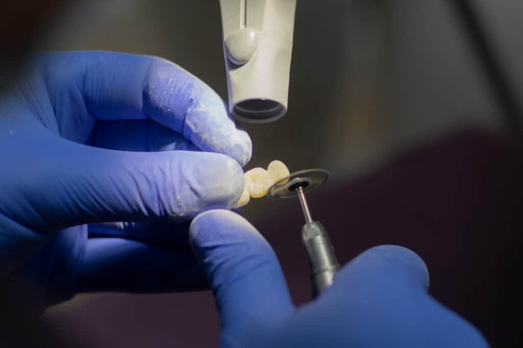 Customised Dental Solutions: Crowns, Aligners, and Implants Woking