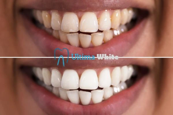 Long lasting results from Ultima White Woking